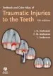 Audiobook Textbook and Color Atlas of Traumatic Injuries to the Teeth author Jens O. Andreasen